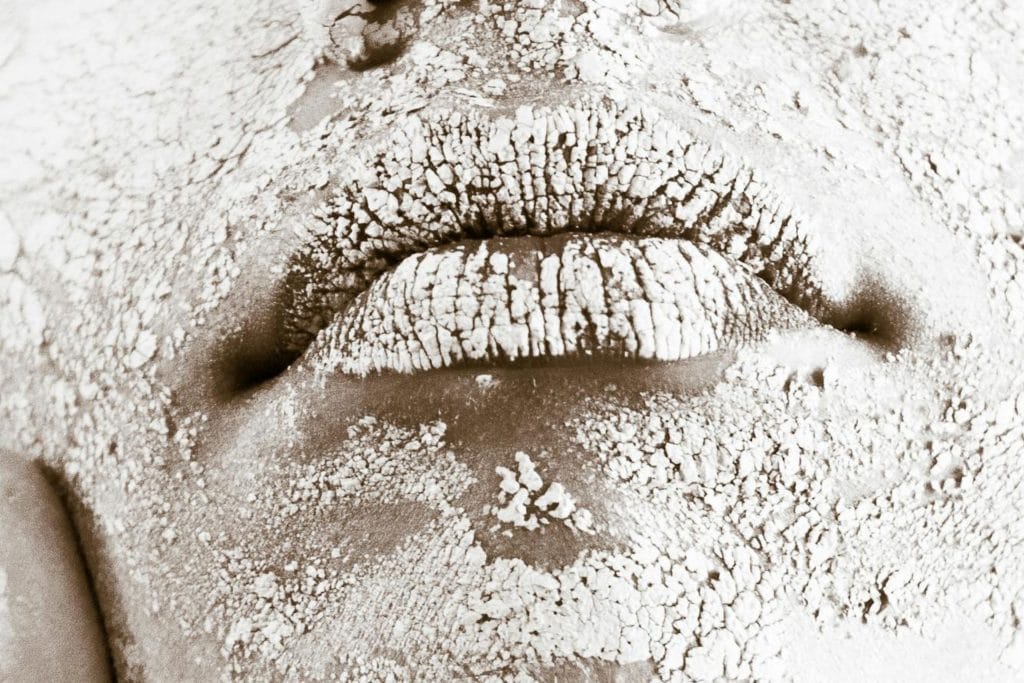 Foto ilustrando pele seca