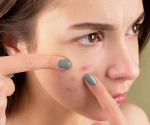 Jovem descobrindo informações sobre acne
